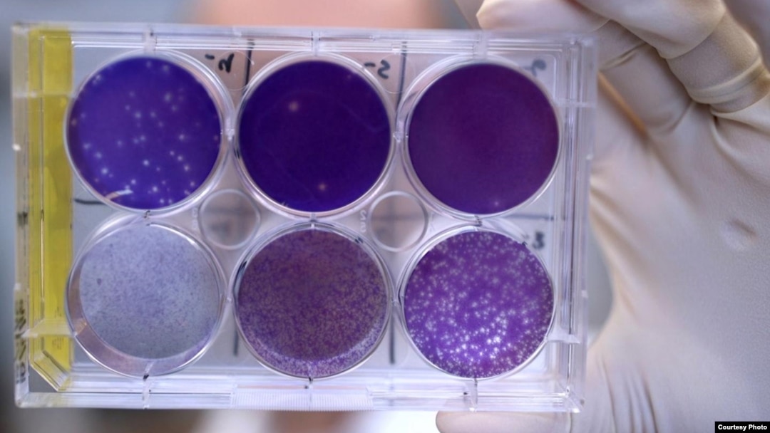 A researcher holds a tray of Zika virus growing in animal cells at Washington University School of Medicine in St. Louis, Missouri. Researchers have identified a human antibody that prevents, in pregnant mice, the fetus from becoming infected and the plac