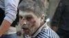 An injured man reacts at a site hit by airstrikes in the rebel-held area of Aleppo's Bustan al-Qasr, Syria, April 29, 2016.