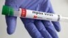 FILE - A test tube labeled "mpox virus positive" is held in this illustration taken Aug. 20, 2024. 